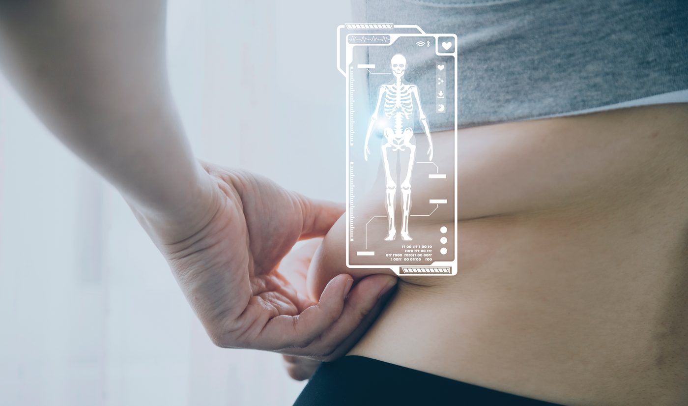 Why Body Composition Analysis at SESC is better