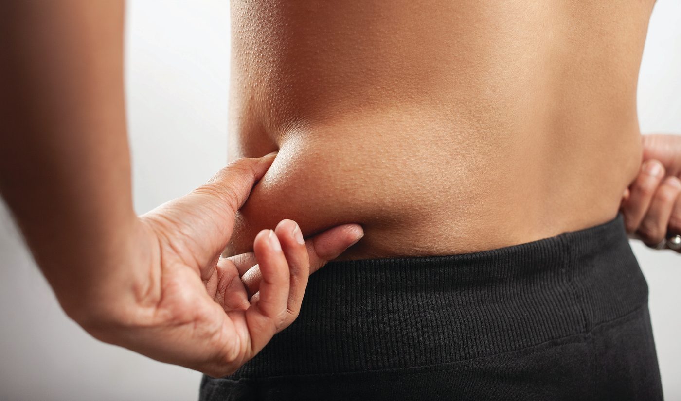 What Creates the Need for a Weight Loss Program?