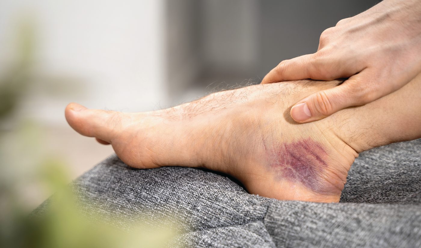 What Causes Ankle Problems?