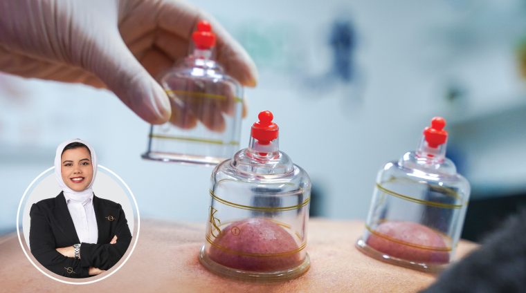 Dynamic Cupping Course Nervana